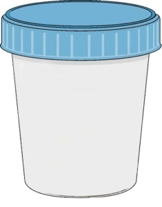 Urine specimen cup