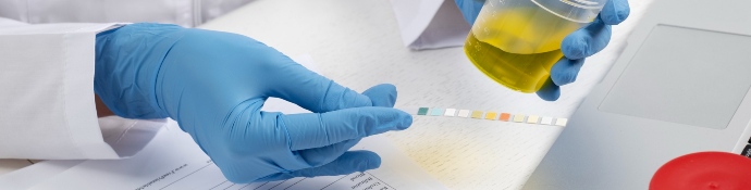 Laboratory preforming urine test