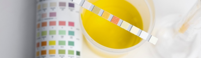 doctor performing medical exam of urine