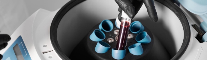 Preparation of blood for injections cosmetologist puts tube of blood in centrifuge
